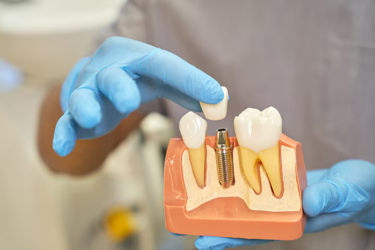 Camas Periodontics